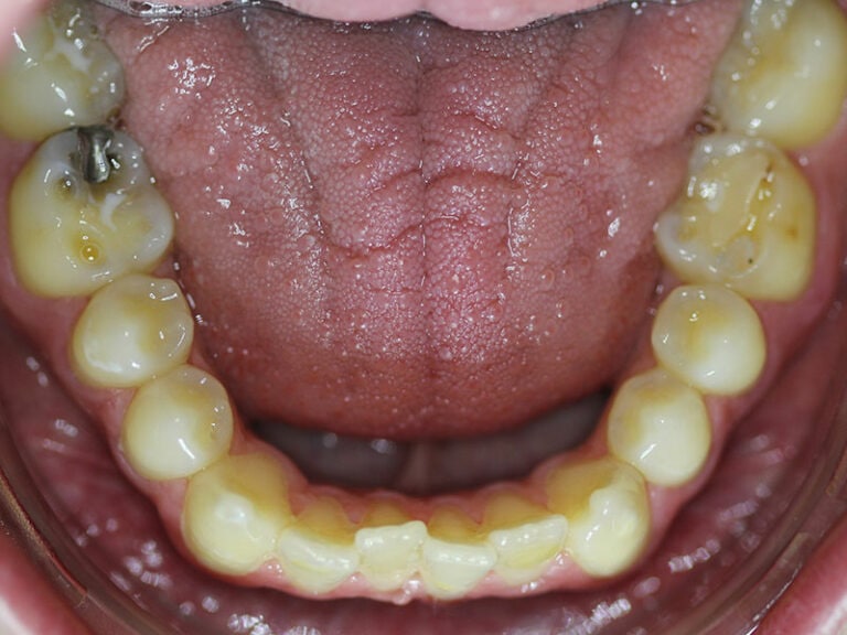 DR. HESSLING Kieferorthopädie Zähne schonend ✚ erhalten
